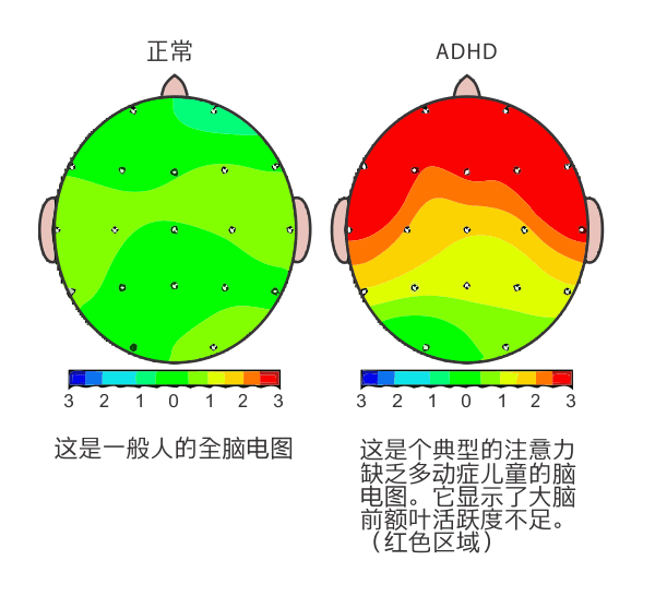 南京八歲孩子記憶力差